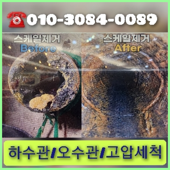 포천하수구