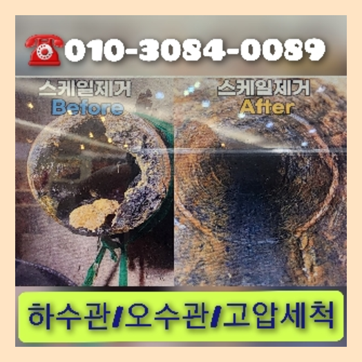 요석제거